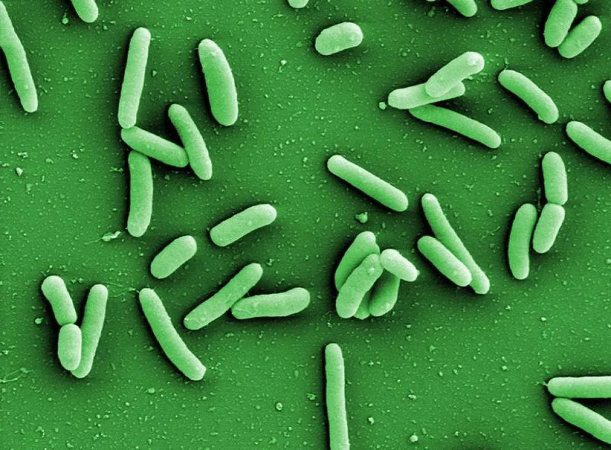 Pseudomonas aeruginosa bacteria (left) often develop resistance to antibiotics and seek protection from external influences in biofilms. (HZI/Manfred Rohde)