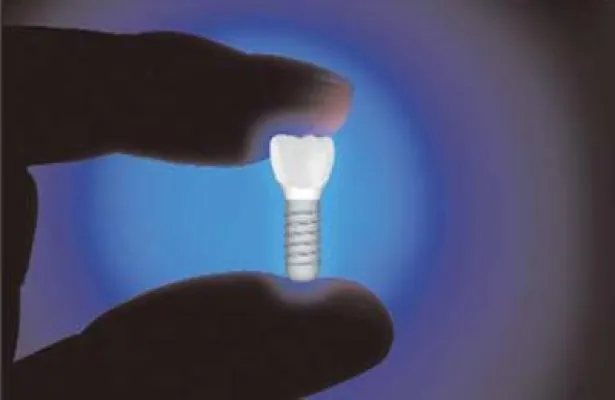 Bild: Aktive Implantatoberflächen