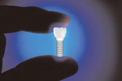 Bild: Aktive Implantatoberflächen