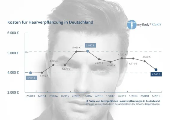 Bild: Volles Haar wird günstiger: Deutlicher Preisrückgang bei Haartransplantationen