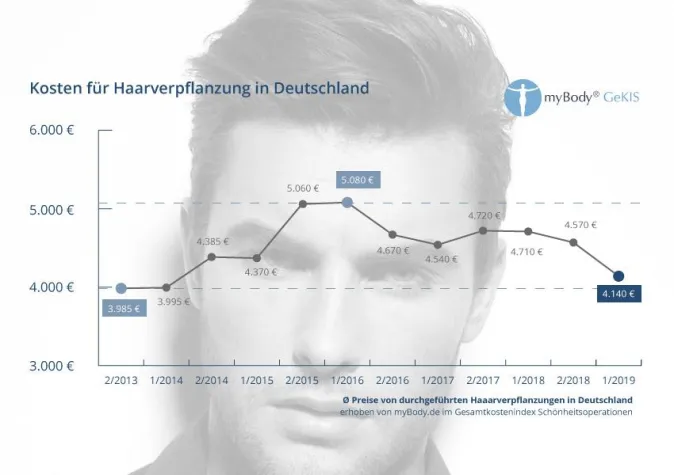 Bild: Volles Haar wird günstiger: Deutlicher Preisrückgang bei Haartransplantationen