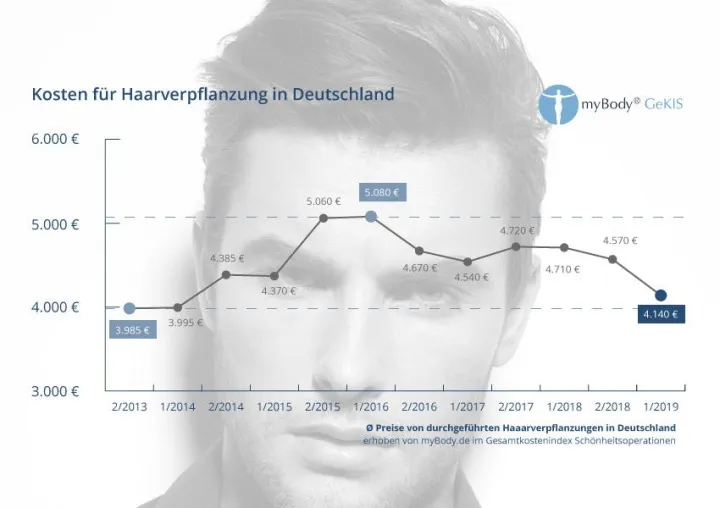 Bild: Volles Haar wird günstiger: Deutlicher Preisrückgang bei Haartransplantationen