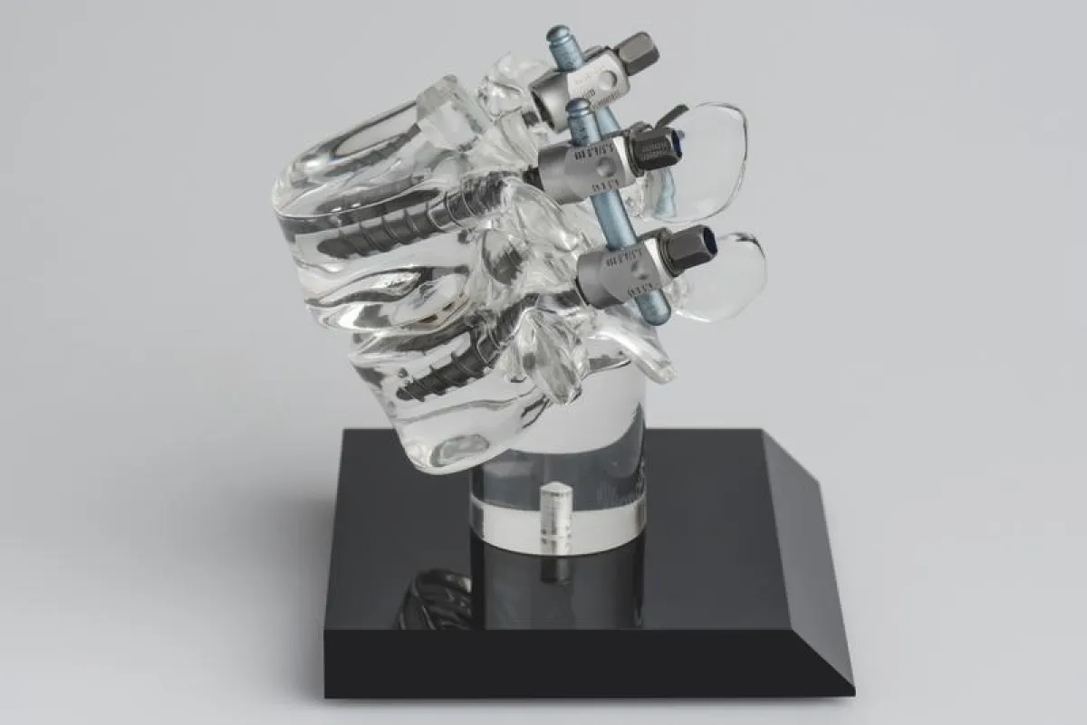 Modell der Wirbelsäule mit vier Pedikelschrauben zur Wirbelsäulenstabilisation. (Pascal Gugler für Insel Gruppe AG)