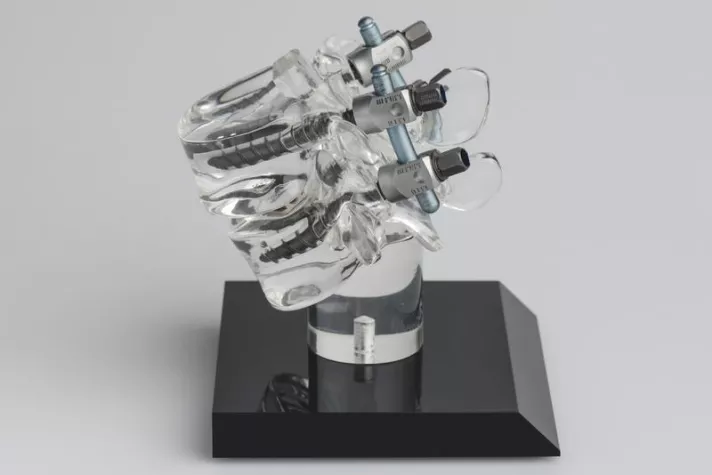 Bild: Sensorgesteuerter Roboter soll höchste Sicherheit bei Wirbelsäulenoperationen ermöglichen