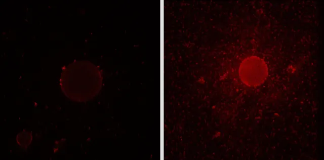 Bild: Bakterium produziert „Bio-Spüli“, um Öl zu verdauen 