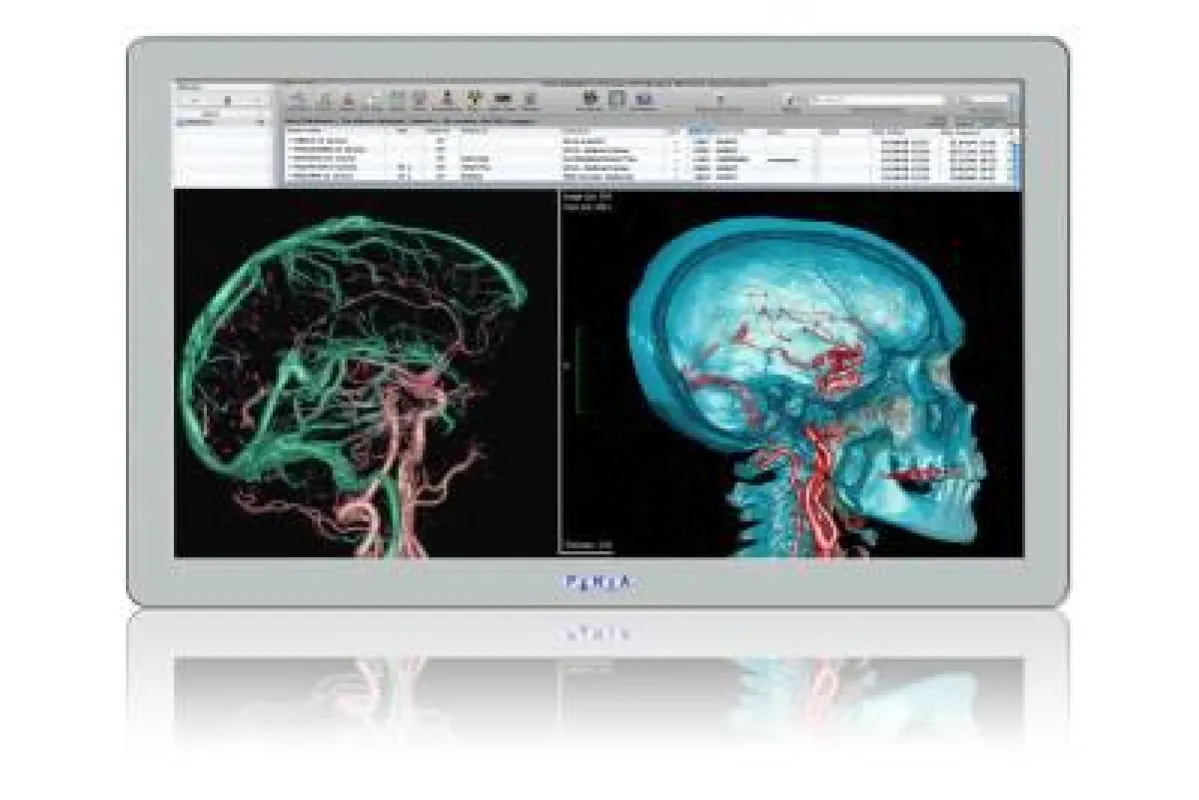 Medical Panel-PC MLC 4-21 von Penta Adlink Technology mit neuesten Intel® Core™ Prozessoren