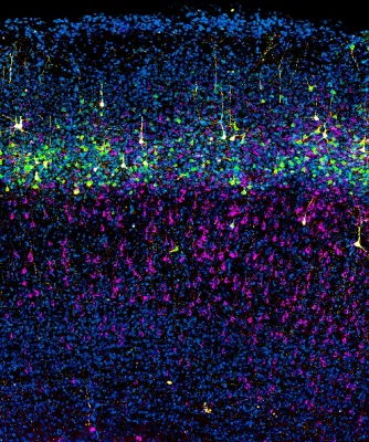 Neuronen-Vorläufer spalten sich früher als gedacht in zwei Zelllinien | Science Advances Bild: Neuronen-Vorläufer spalten sich früher als gedacht in zwei Zelllinien | Science Advances