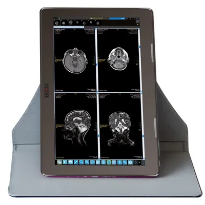 Bild: MED-TAB - und die Revolution in der portablen medizinischen Bilddiagnostik