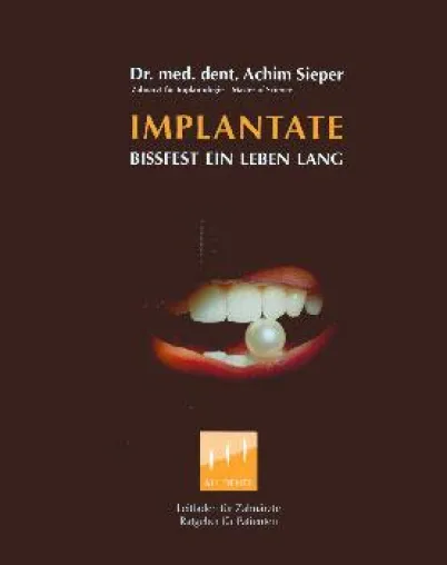 Bild: Bissfest - Buch über Implantate