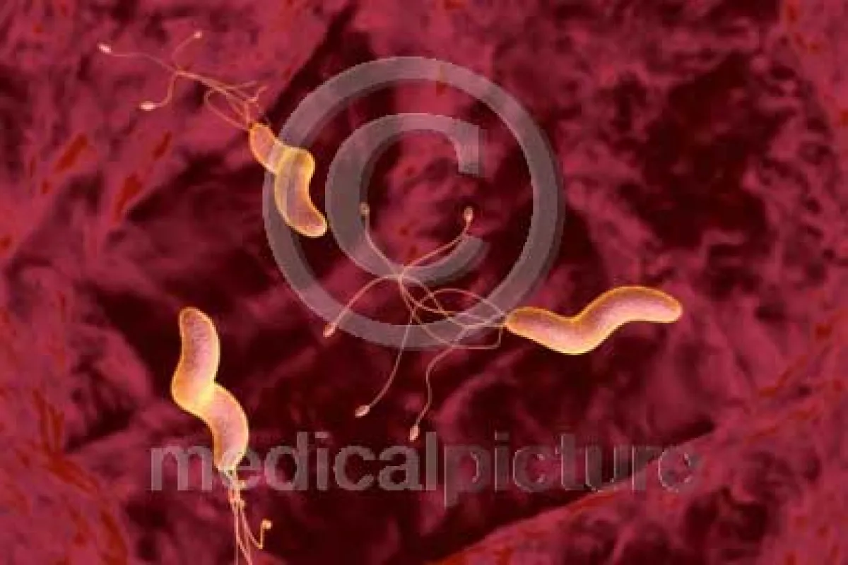 Helicobacter Pylori by medicalpicture