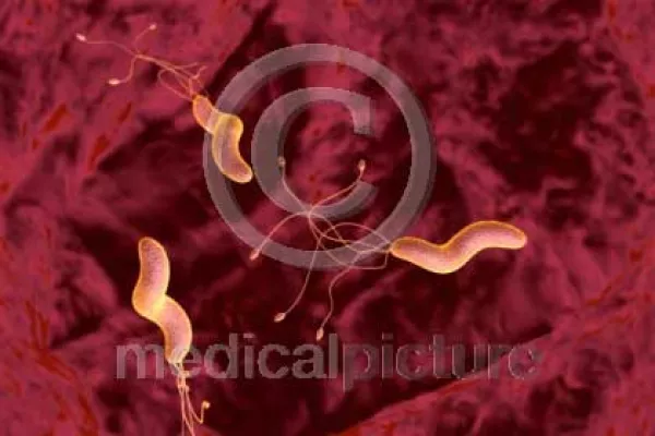 Bild: Helicobacter pylori - Magendauerbrenner bei medicalpicture