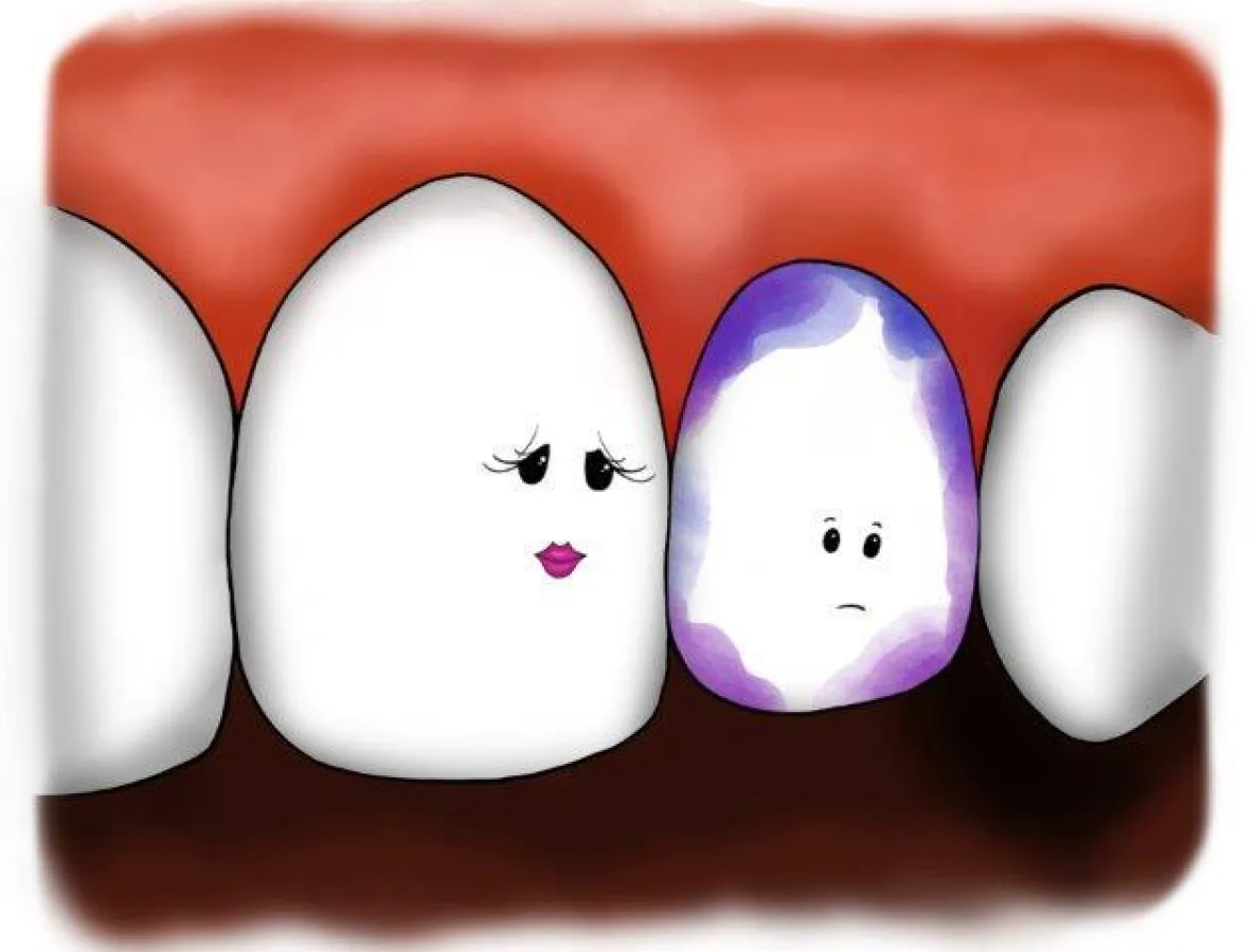 Der kleine, kranke Zahn und seine besorgte Mutter.