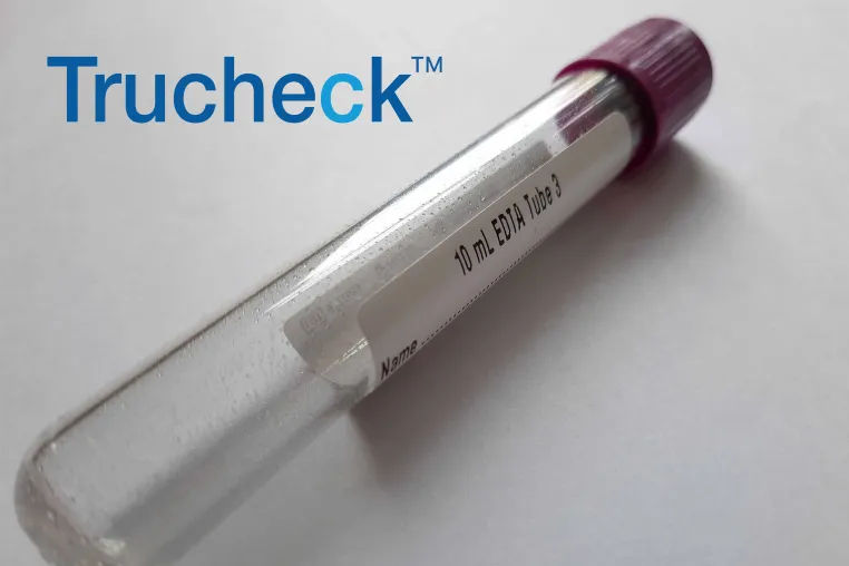 US FDA erteilt Breakthrough Device Designation für Bluttest zur Früherkennung von Brustkrebs Bild: US FDA erteilt Breakthrough Device Designation für Bluttest zur Früherkennung von Brustkrebs