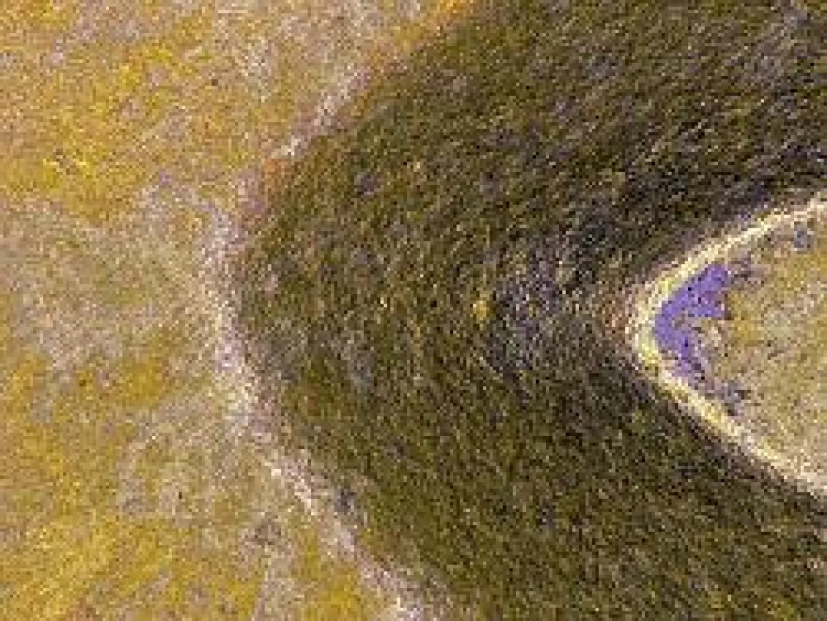 Interferenz-mikroskopische Aufnahme einer deutlich degradierten Oberflächenbeschichtung