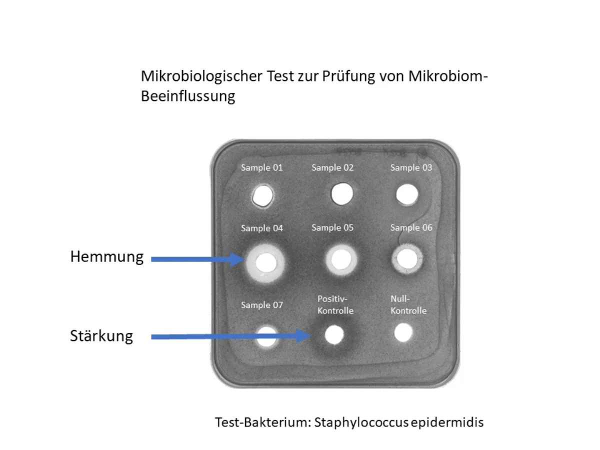 Die Tests zeigten: Viele Cremes verhindern das Wachstum gesunder Bakterien im Umfeld (weiße Kreise) (© BELANO medical AG)