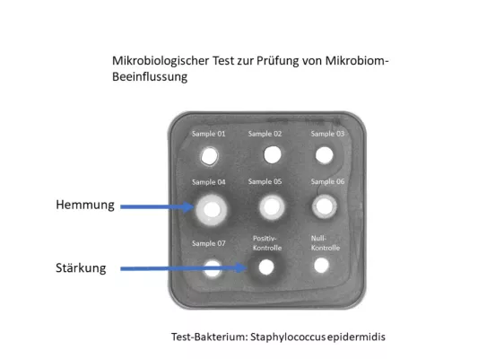 Bild: Studie: Viele Hautcremes schaden dem Mikrobiom der Haut