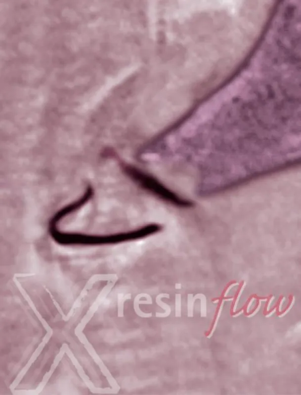 X-resin flow Röntgenopaker Silikonlack. Prothetisch orientiert, einfach und schnell