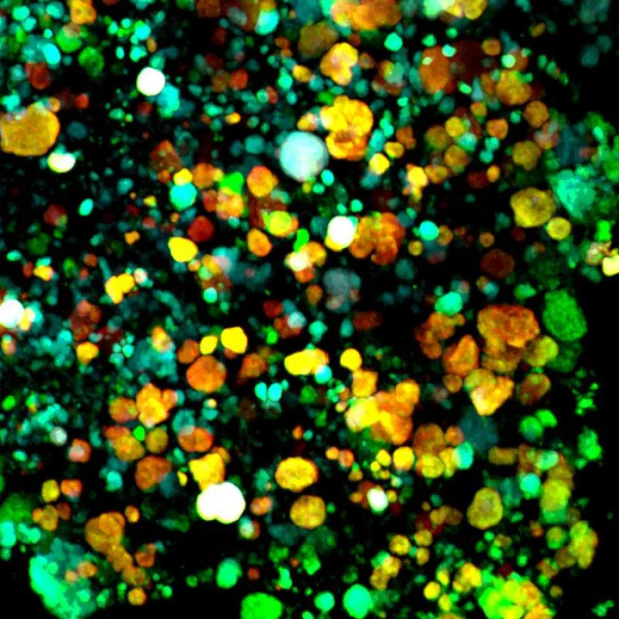 Eine mikrobielle Gemeinschaft. (Copyright: Holger Daims, Universität Wien)