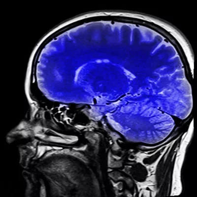 Bild: CME Live-Webinar: GOÄ Anwendung für Radiologen, 24.10., 18.30 Uhr