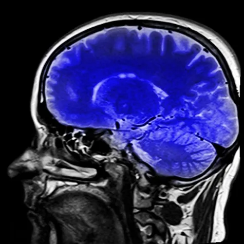 Bild: CME Live-Webinar: GOÄ Anwendung für Radiologen, 24.10., 18.30 Uhr