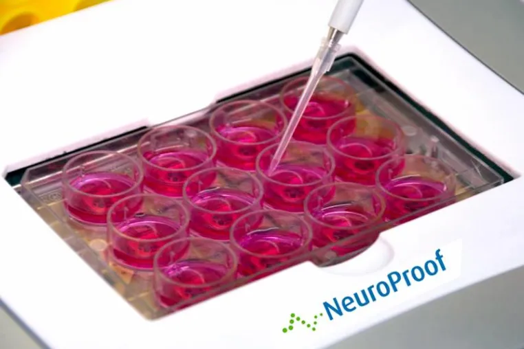 NeuroProof startet neue Finanzierungsrunde Bild: NeuroProof startet neue Finanzierungsrunde