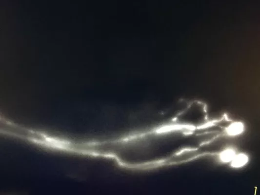 Bild: Störungen im Körper-Abwasser-Kanal