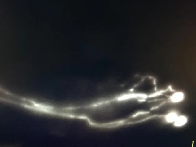 Störungen im Körper-Abwasser-Kanal Bild: Störungen im Körper-Abwasser-Kanal