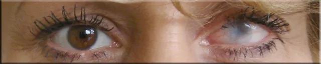 Schutz für das Augenlicht Bild: Schutz für das Augenlicht