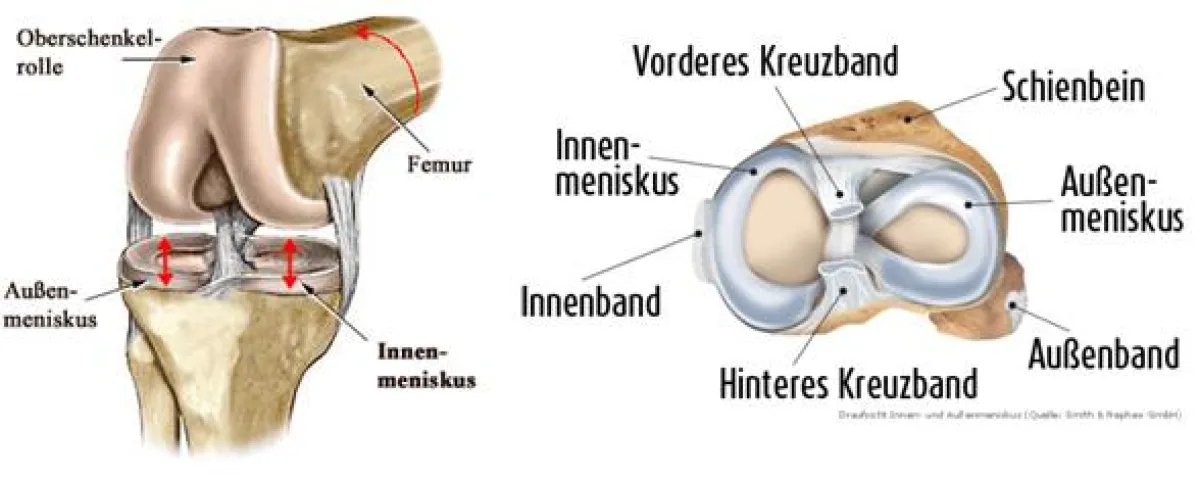Darstellung Meniskus