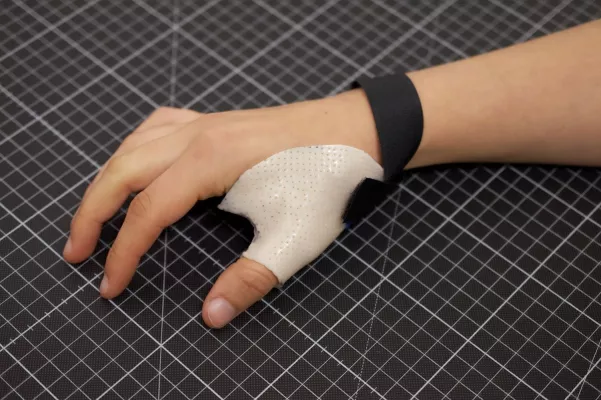 Ergotherapeutische Schienen Bild: Ergotherapeutische Schienen