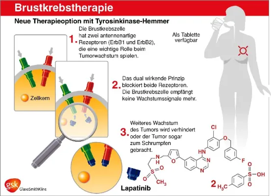 Bild: Mammakarzinom - Studienrekrutierung wegen positiver Resultate vorzeitig gestoppt