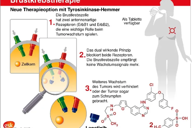 Bild: Mammakarzinom - Studienrekrutierung wegen positiver Resultate vorzeitig gestoppt