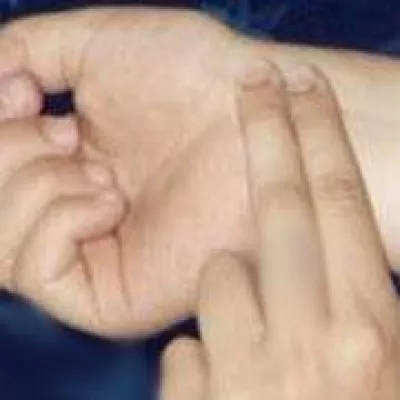 Bild: Vorbeugen ist besser als Ausbrennen