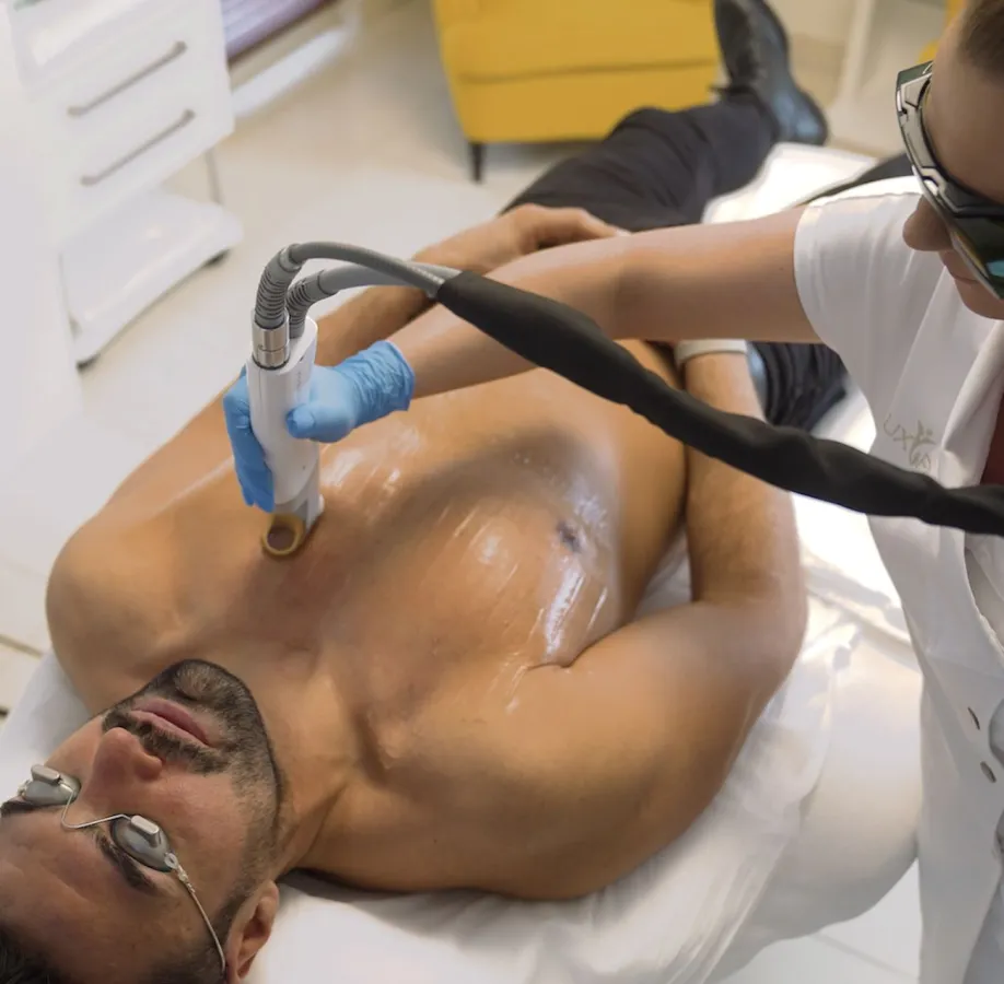 Dauerhafte Haarentfernung mit dem YAG Laser