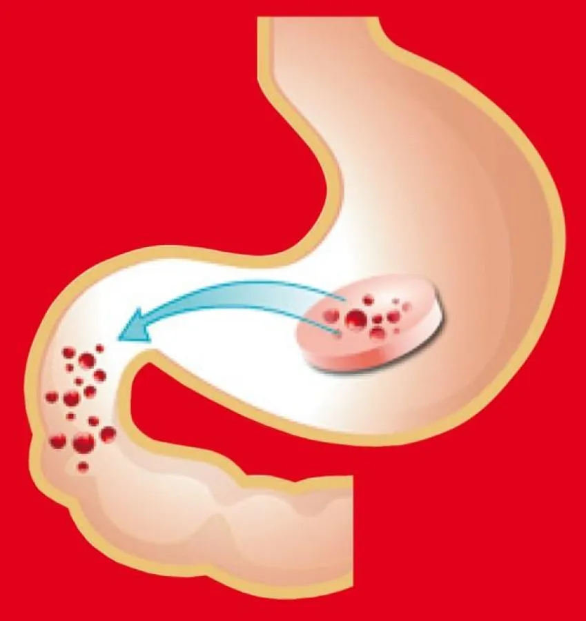 Vom Magen in den Dünndarm Foto:Hübner