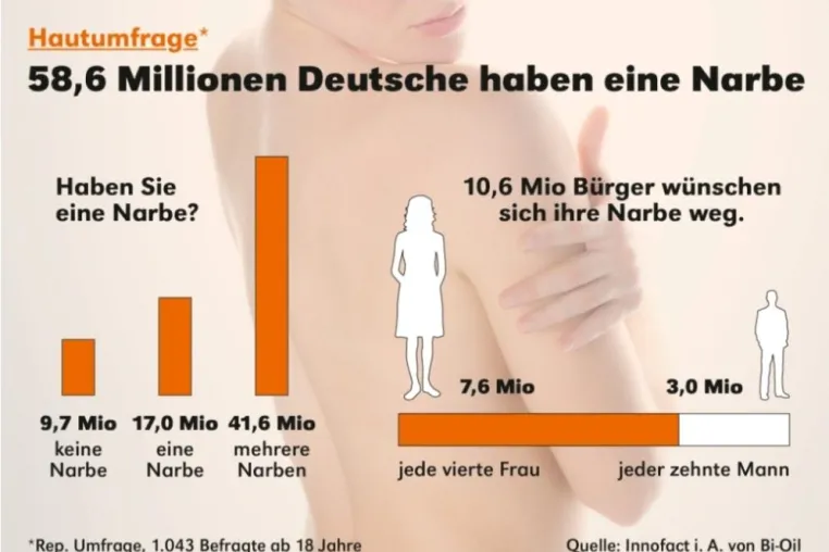 Bild: So viele Narben haben die Deutschen
