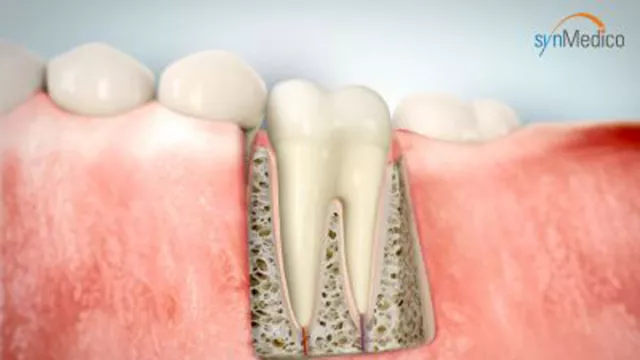 Bild: Aktuelle Entwicklungen in der modernen Endodontie, und wie Patienten davon profitieren