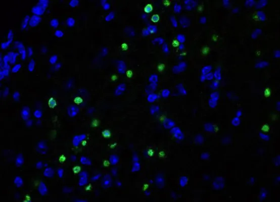Bild: Neues BMBF-Projekt: Zelltodblocker gegen Neurodegeneration und Demenz