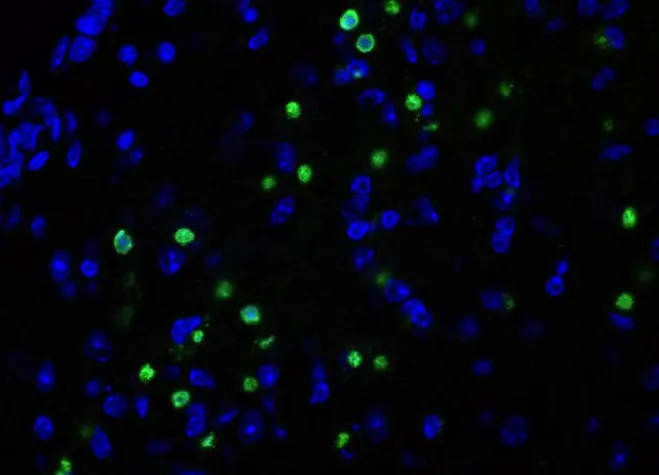 Bild: Neues BMBF-Projekt: Zelltodblocker gegen Neurodegeneration und Demenz