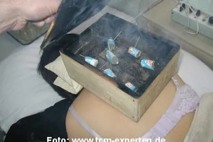 Ein Bestseller - Wärmetherapie in der TCM und Akupunktur jetzt bei Hwato erhältlich Bild: Ein Bestseller - Wärmetherapie in der TCM und Akupunktur jetzt bei Hwato erhältlich
