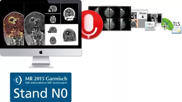 Bild: aycan OsiriX PRO 3.0 Workshop auf dem Internationalen MRI Symposium 2015 in Garmisch-Partenkirchen