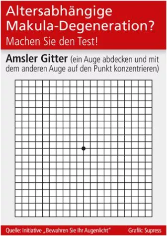 Bild: Altersabhängige Makula-Degeneration?