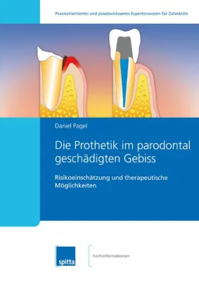 Bild: Die Prothetik im parodontal geschädigten Gebiss