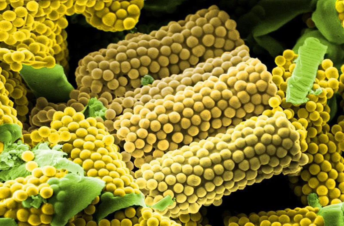 Die zylinderförmigen Wirkstoff-Transporter sehen mit ihrer noppigen Struktur aus wie Mais. Doktoranden von Marc Schneider färbten die Rasterelektronenmikroskop-Aufnahme entsprechend ein. (Foto: Marc S