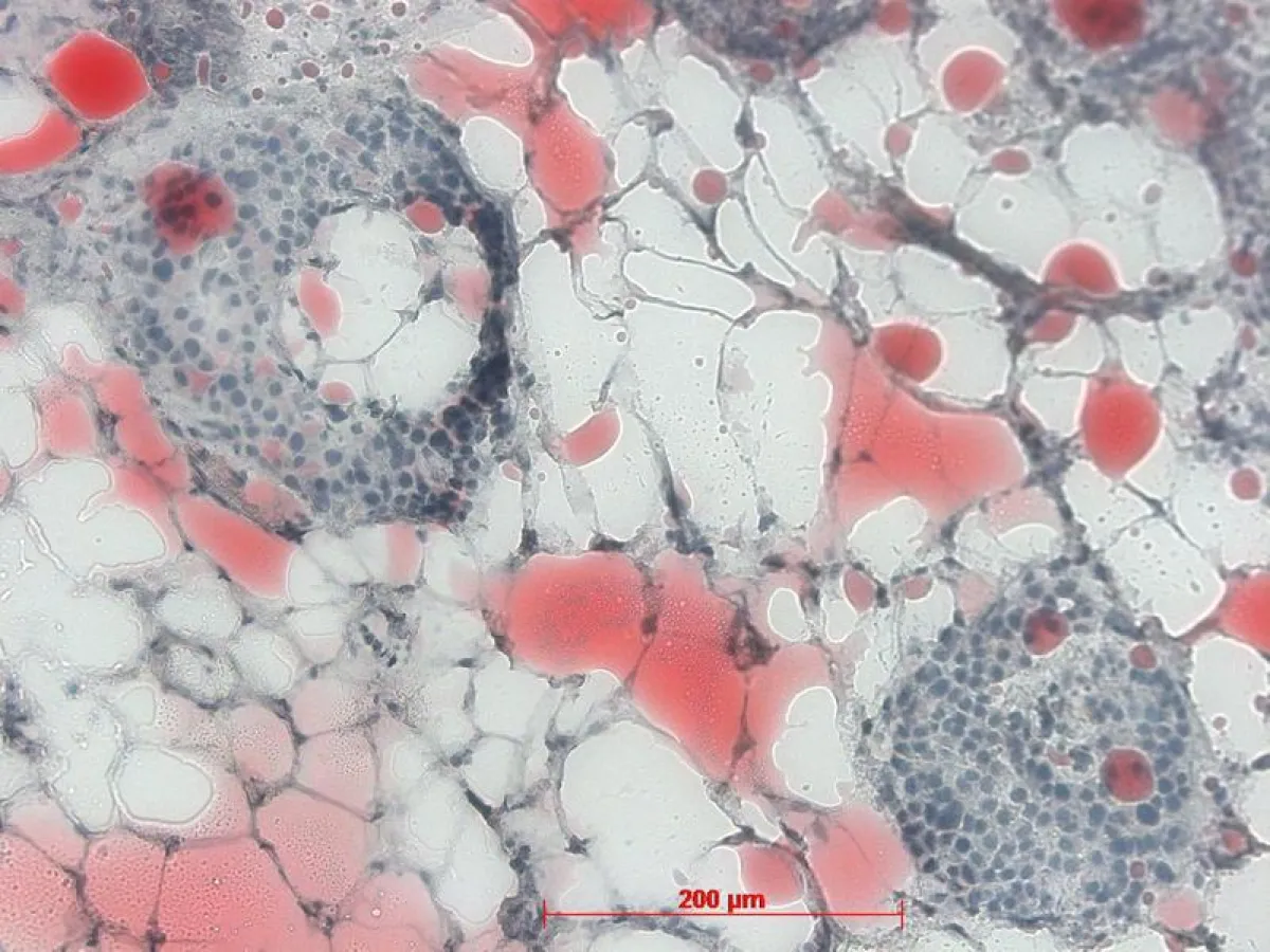 Adipose cells (white/dyed red) next to an insulin-producing islet in the pancreas. (Source: IDM) (Image source: IDM)