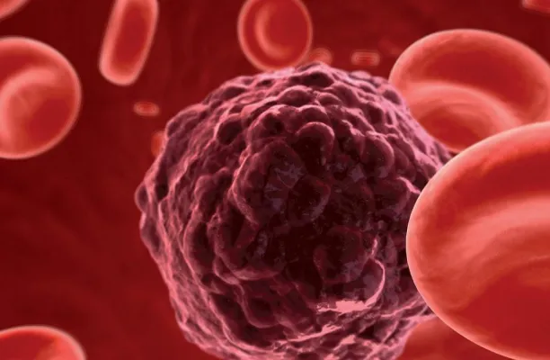 Bild: Wandlungsfähige Tumorzellen können Erfolge von Hormontherapien schmälern – aber auch verbessern