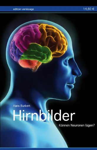 Hirnbilder – Können Neuronen lügen? Bild: Hirnbilder – Können Neuronen lügen?