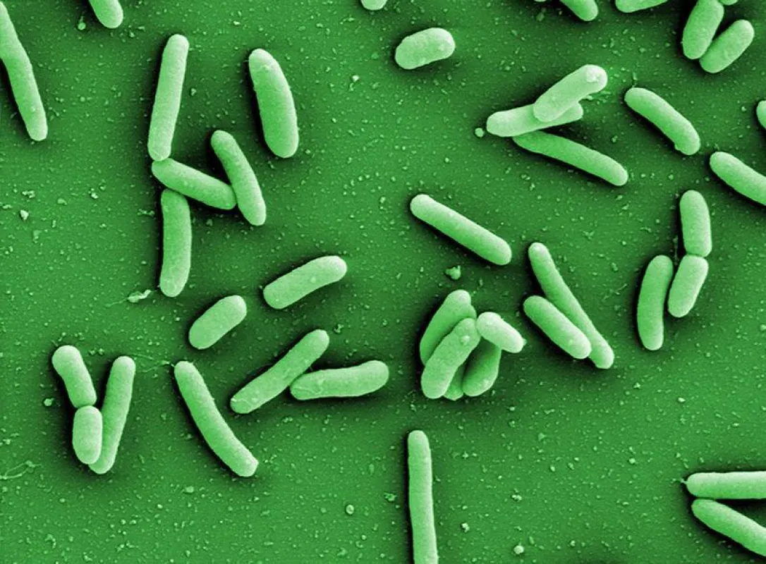 Bakterien der Art Pseudomonas aeruginosa (links) entwickeln häufig Resistenzen gegen Antibiotika und schützen sich zudem in Biofilmen vor äußeren Einflüssen. (HZI/Manfred Rohde)