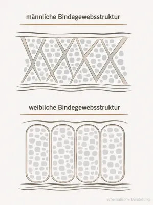 Bild: Mechanik ist nicht unisex.