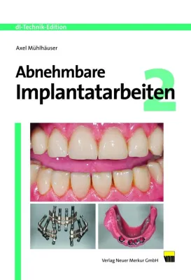 Bild: Abnehmbare Implantatarbeiten 2
